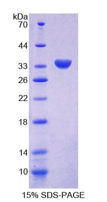Human CHN2 / Chimerin 2 Protein (Recombinant His-T7)