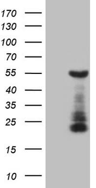 Monoclonal Mouse anti-Human GATA3 Antibody (clone OTI1A5, aa155-443, IF, WB)