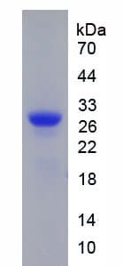 Rat HMG2 / HMGB2 Protein (Recombinant His, N-Terminal)