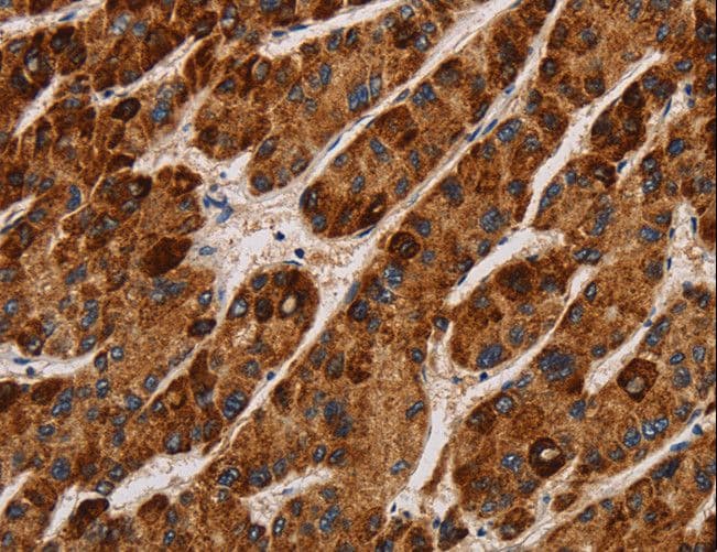 IHC-plus™ IL17RA Antibody