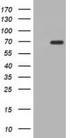Monoclonal Mouse anti-Human AK5 / Adenylate Kinase 5 Antibody (clone OTI1D5, IF, WB)