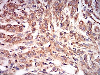 IHC-plus™ PRKAG1 / AMPK Gamma 1 Antibody (aa230-331, clone 7H3E9)