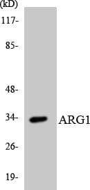 Polyclonal Rabbit anti-Human ARG1 / Arginase 1 Antibody (aa46-95, WB)