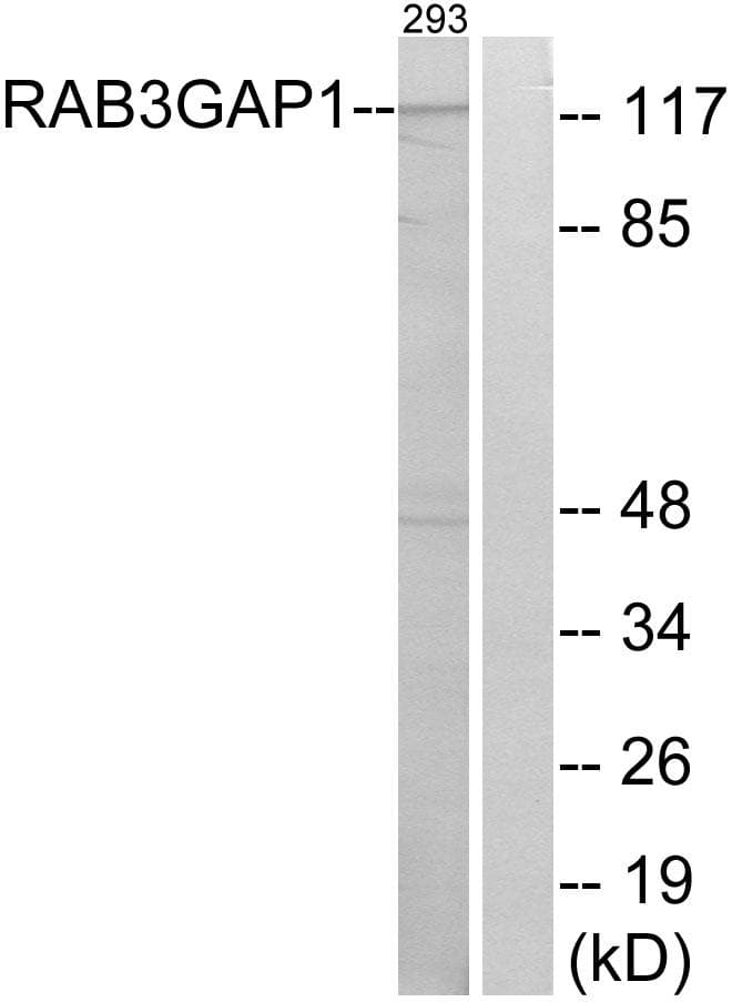 RAB3GAP1 Antibody