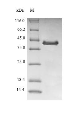Human FXN / Frataxin Protein (Recombinant 10His-SUMO, N-terminus + Myc, C-terminus)
