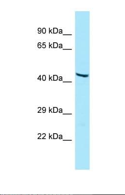 GIPR / GIP Receptor Antibody (N-Terminus)