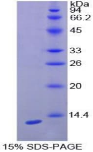 Rat CXCL10 / IP-10 Protein (Recombinant His-T7)
