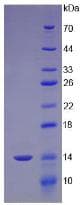Human CUBN / Cubilin Protein (Recombinant His, N-Terminal)