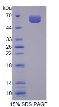 Human IL20RA Protein (Recombinant His-GST)