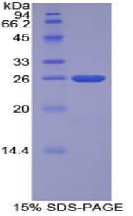 Bovine TFPI2 Protein (Recombinant His)