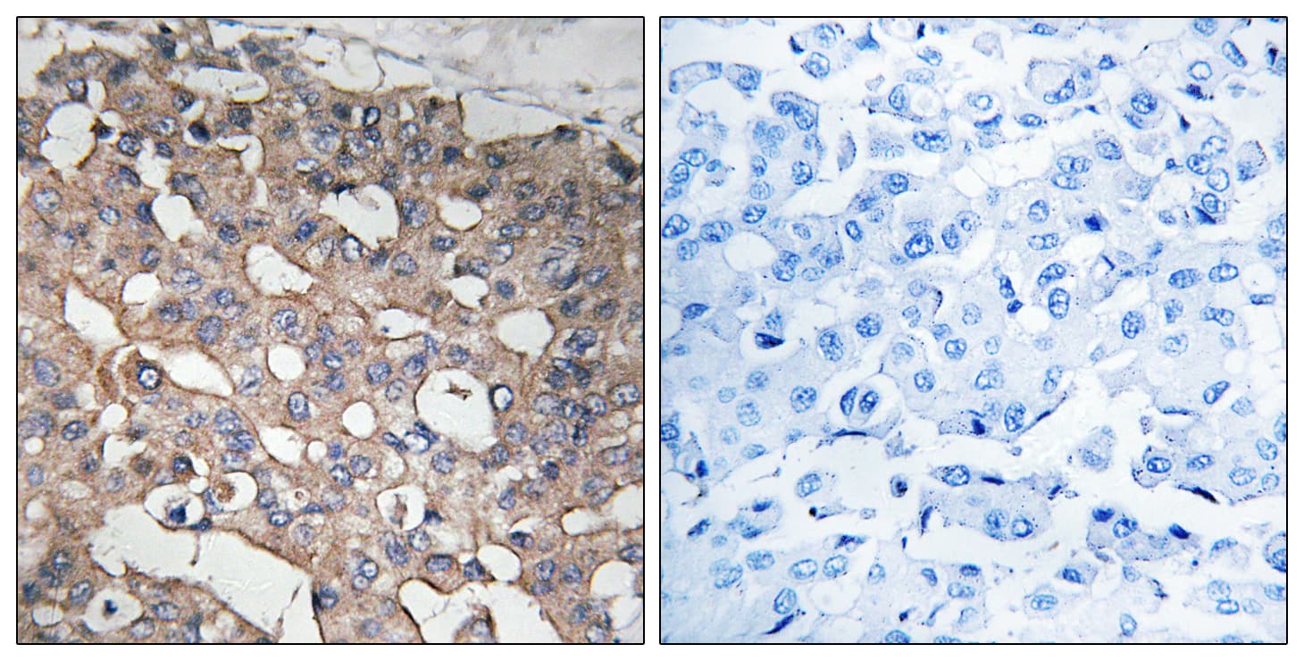 Polyclonal Rabbit anti-Human STMN1 / Stathmin / LAG Antibody (aa26-75, IHC)