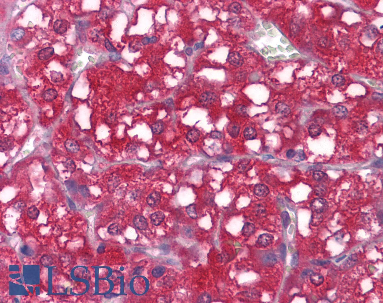 IHC-plus™ WNT1 Antibody (clone 10C8)