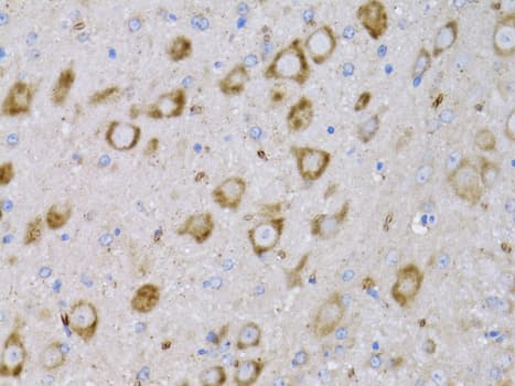 Polyclonal Rabbit anti-Human NGF Antibody (IHC, WB)