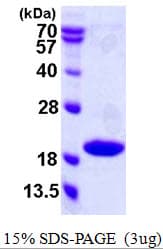 Human CDKN2C / p18 INK4c Protein (Recombinant His)