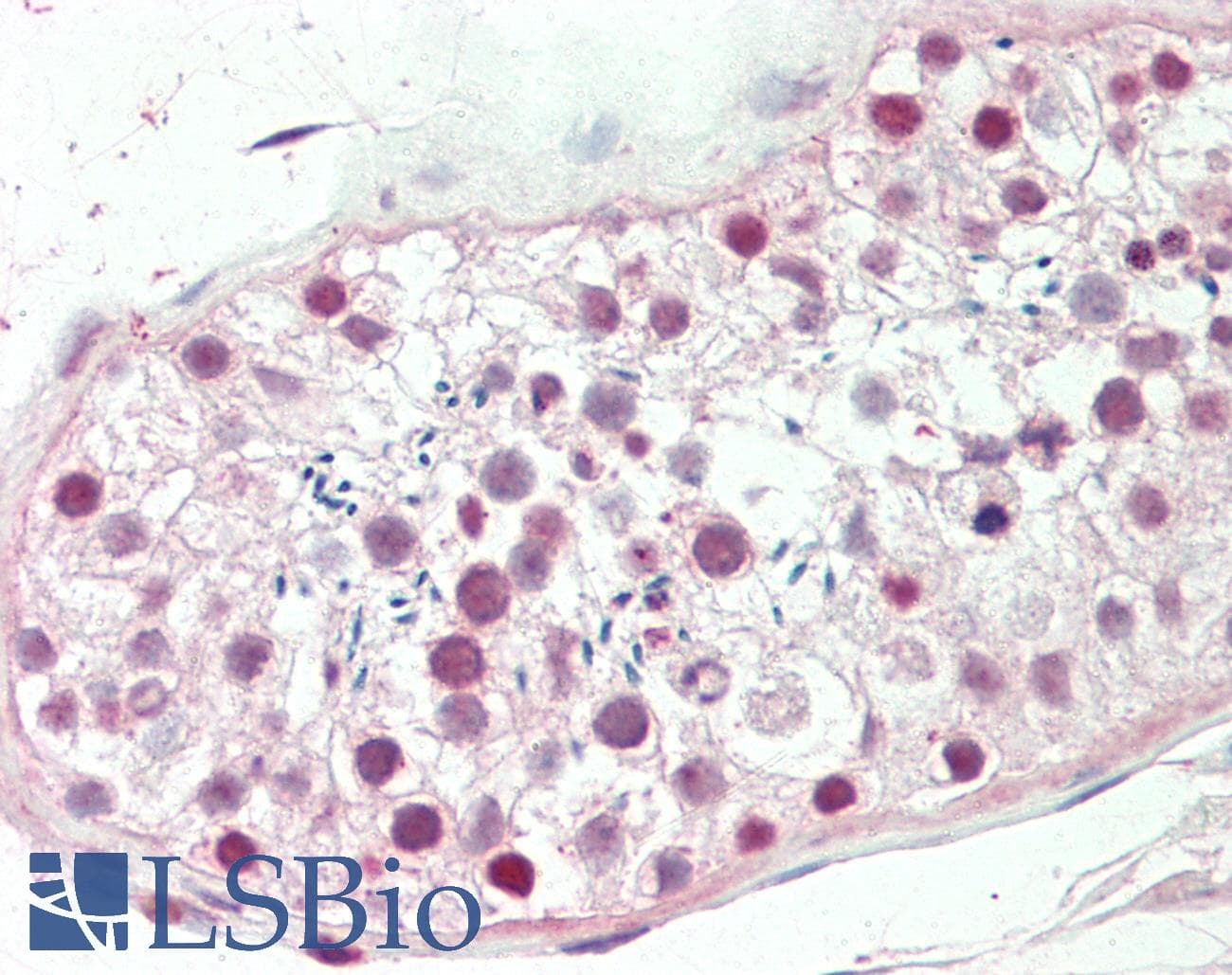 IHC-plus™ Monoclonal Mouse anti-Human ETV5 / ERM Antibody (clone 3H3, aa181-291, IHC, WB)