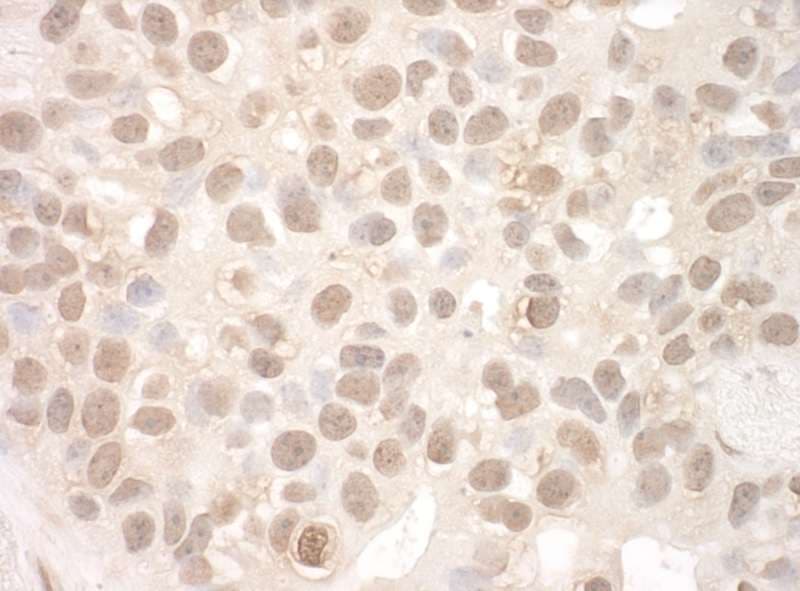 EYA2 Antibody (aa100-150)