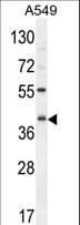 C5AR1 / CD88 / C5a Receptor Antibody (aa175-201)