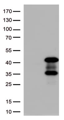 PRKAB1 / AMPK Beta 1 Antibody (aa2-270, clone OTI8D5, Carrier-free)