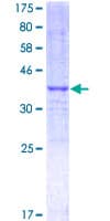 Human NCOA3 / SRC-3 / AIB1 Protein (Recombinant GST, N-terminus)