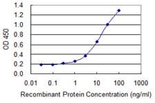 Monoclonal Mouse anti-Human Dermatopontin / DPT Antibody (clone 2A11)