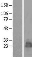 Human MARCH2 Protein (Over-Expression Lysate Myc-DDK (Flag))