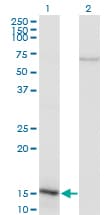 NIP45 / NFATC2IP Antibody (clone 3E9-B7)