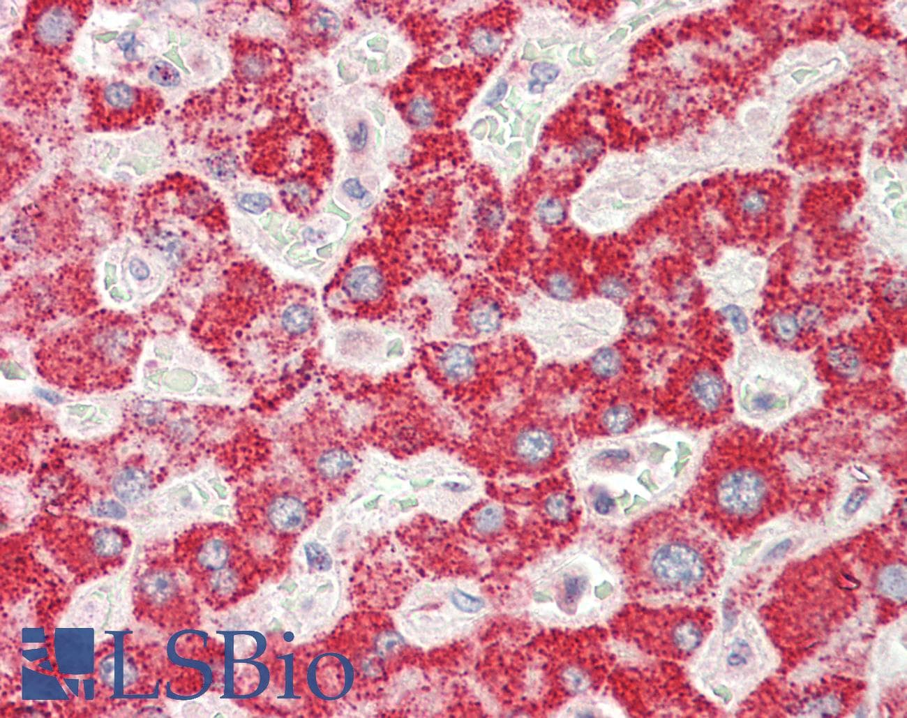 IHC-plus™ GGT1 / GGT Antibody (aa27-40)