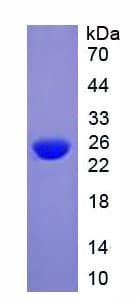 Human CRP / C-Reactive Protein (Native)