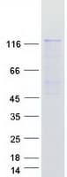 Human SMC6 Protein (Recombinant Myc-DDK (Flag))