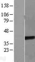 TEL-2 / ETV7 Protein (Over-Expression Lysate Myc-DDK (Flag))