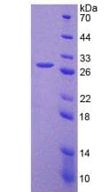 Mouse FAP Alpha Protein (Recombinant His-T7)