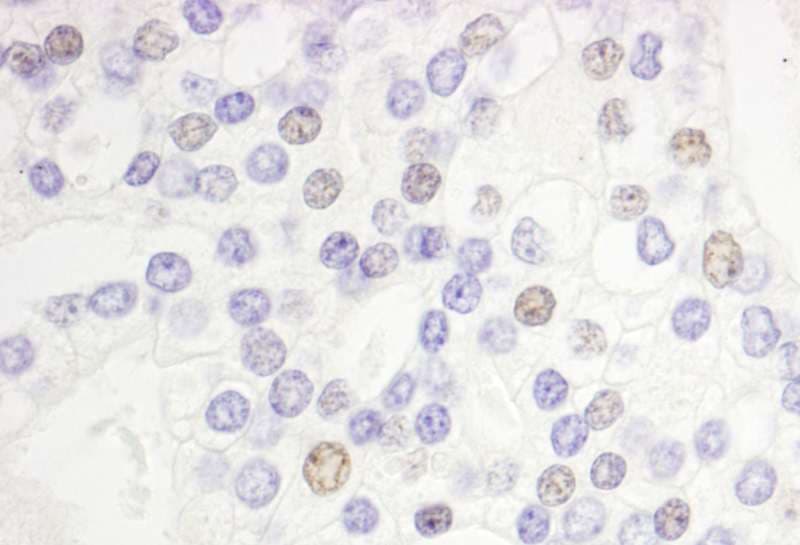 DEK Antibody (aa225-275)