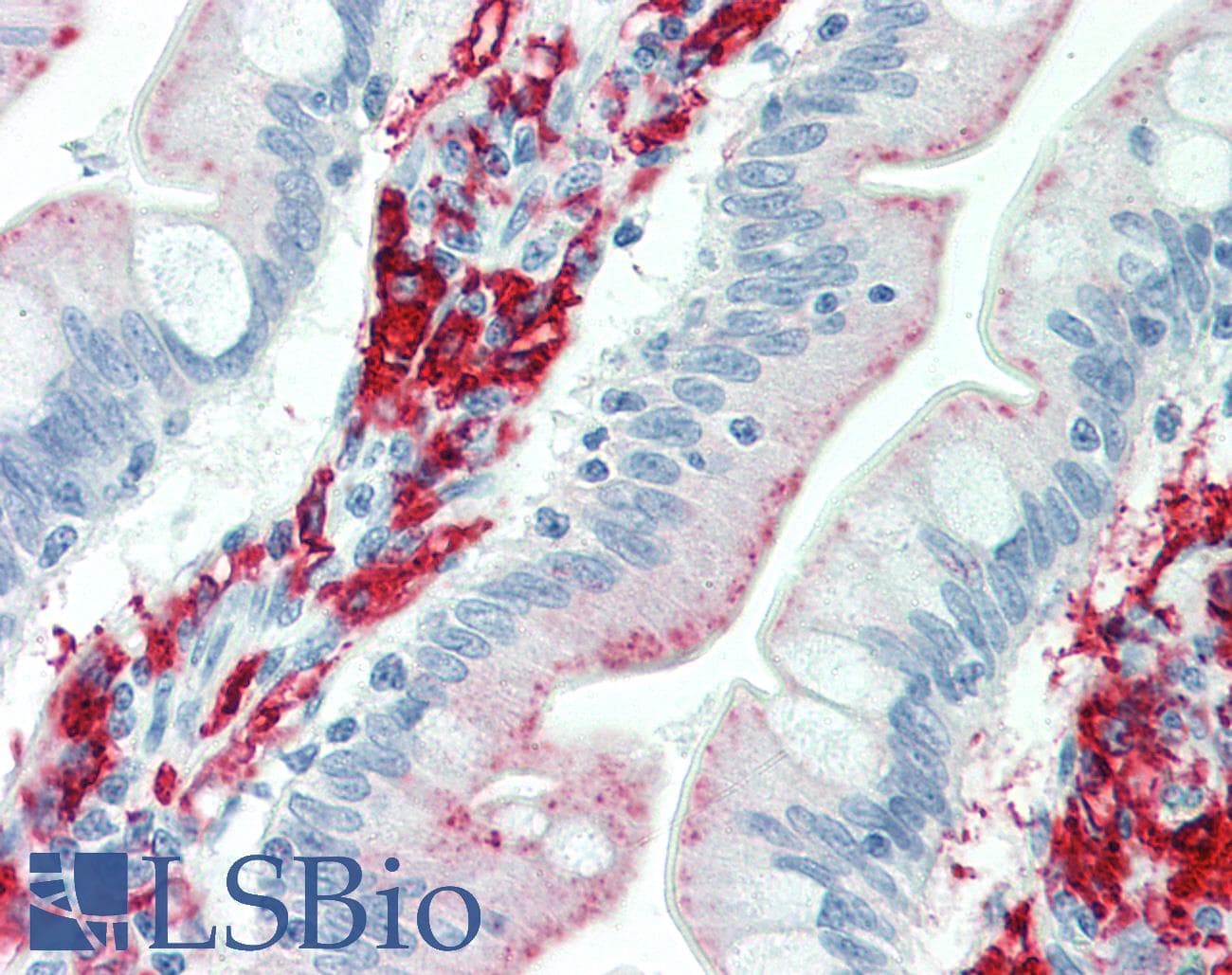 IHC-plus™ HLA-DP+DQ+DR Antibody (clone WR18)