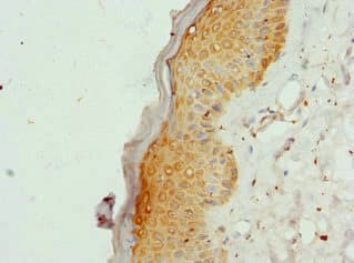 COL9A3 / Collagen IX Antibody
