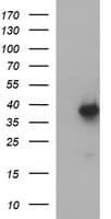 MCAT Antibody (clone OTI2G1)