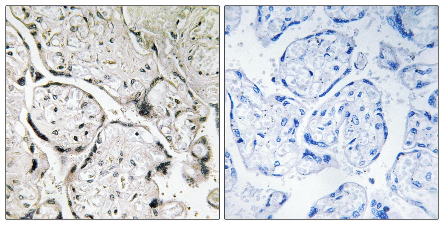 SARA2 / SAR1B Antibody