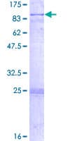 Human CRAT Protein (Recombinant GST)