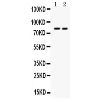 Polyclonal Rabbit anti-Human ZP2 Antibody (aa511-544, IHC, WB)