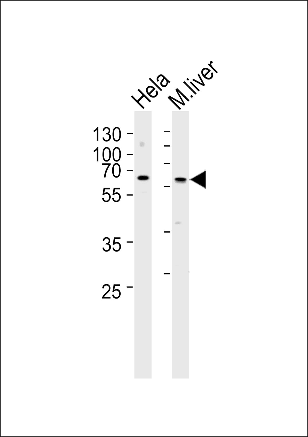 Polyclonal Rabbit anti-Human SQSTM1 Antibody (Ser351, WB)