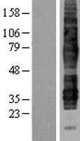 C5AR2 / GPR77 / C5L2 Protein (Over-Expression Lysate Myc-DDK (Flag))
