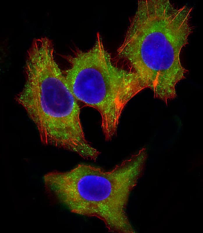 HCK Antibody (clone 1508CT602.13.1)