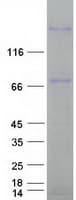 Human LAMC3 / Laminin Gamma 3 Protein (Recombinant Myc-DDK (Flag))