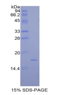 Rat PTN / Pleiotrophin Protein (Recombinant His, N-Terminal)