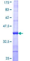 Human KERA / Keratocan Protein (Recombinant GST, N-terminus)