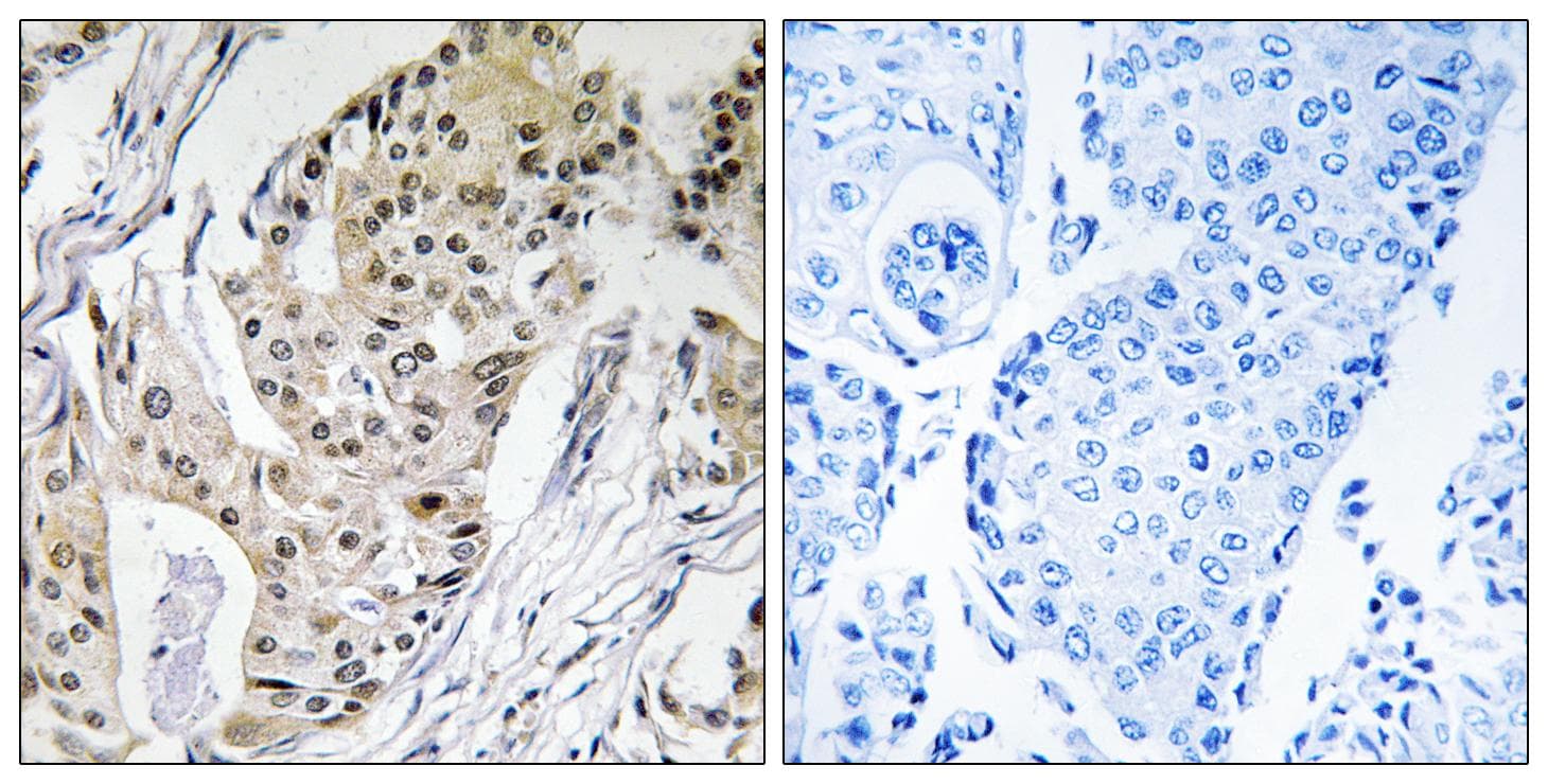 POLE4 / p12 Antibody