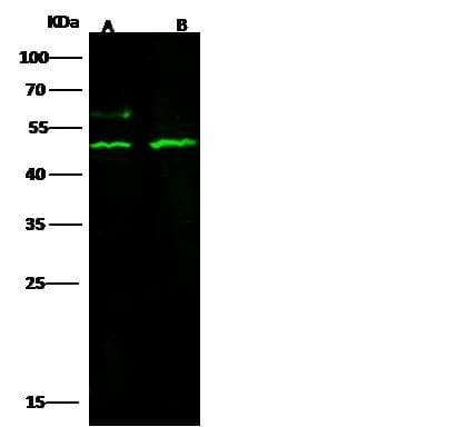 Polyclonal Rabbit anti-Human KDM8 / JMJD5 / FLJ13798 Antibody (Preservative Free, IHC, WB)