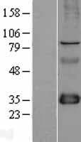 SLIM / FHL1 Protein (Over-Expression Lysate Myc-DDK (Flag))