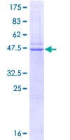 Human CAV1 / Caveolin 1 Protein (Recombinant GST)