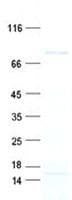 Human TNXB / Tenascin XB Protein (Recombinant His, N-Terminal)