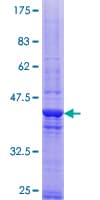 Human CEP290 Protein (Recombinant GST)